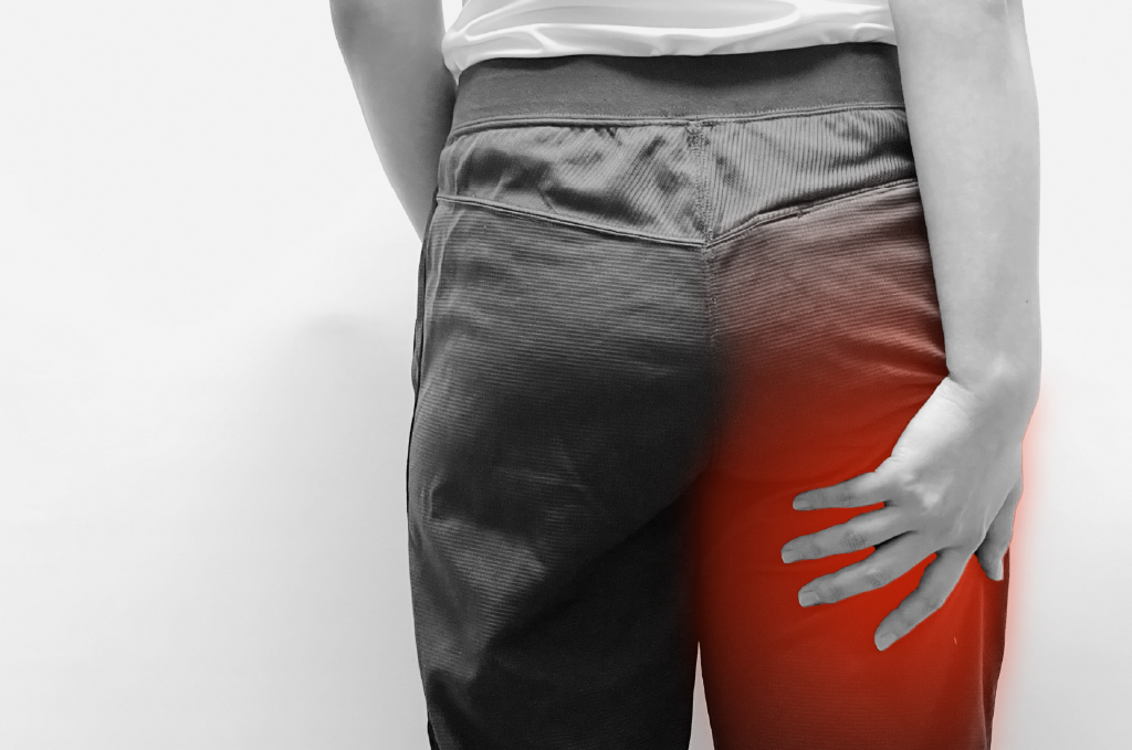 座骨神経痛イメージ画像