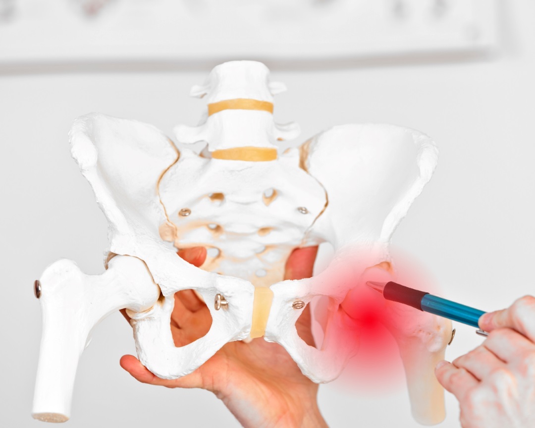 リファイン整骨院・整体院の股関節痛のイメージ