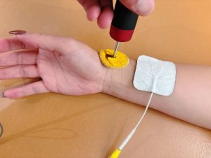 リファイン整骨院・整体院ハイボルト施術イメージ画像